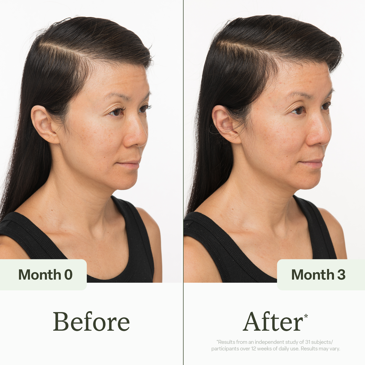 30ml Scalp Serum Divi Official LLC